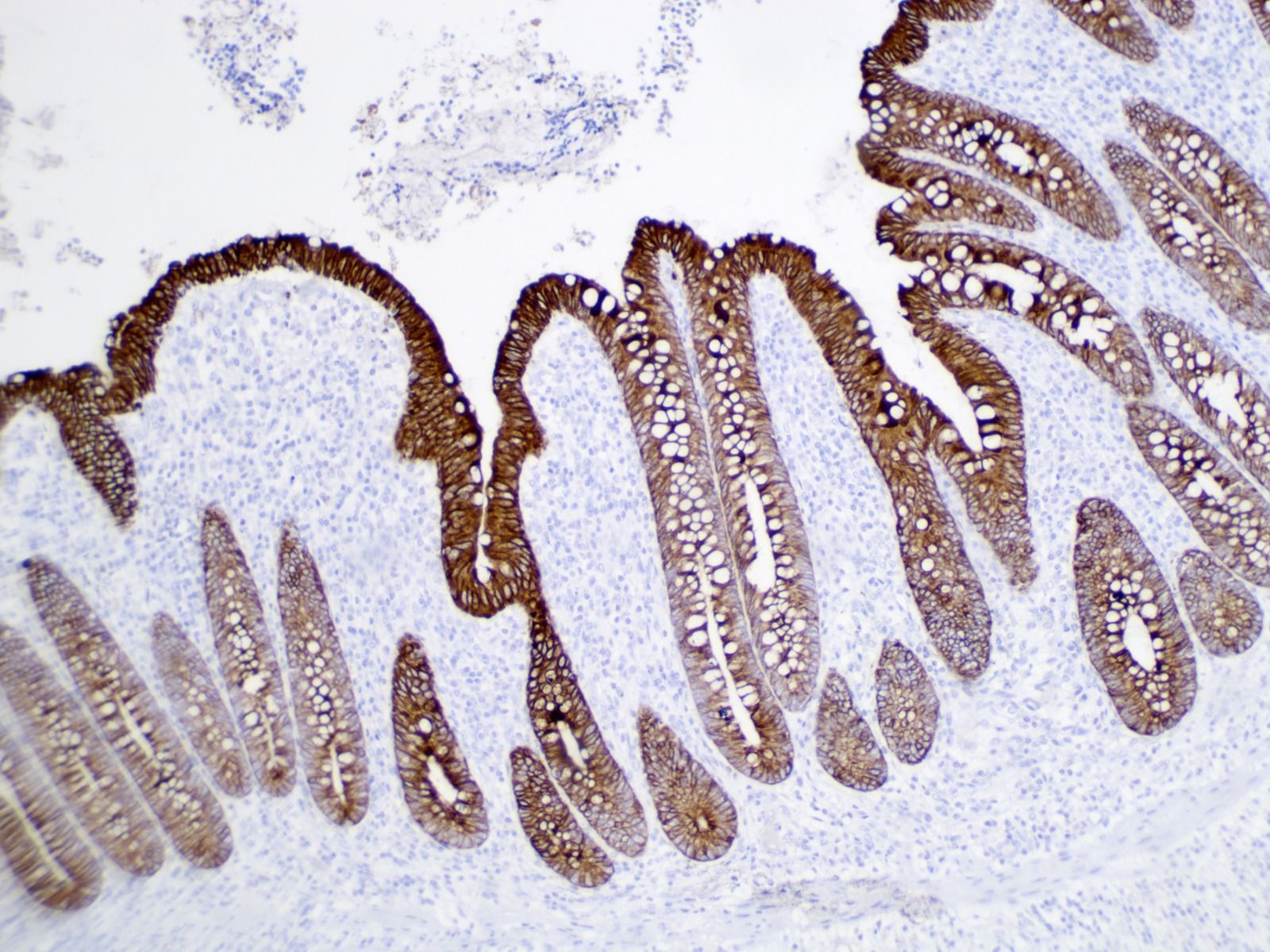 Vista microscópica del tejido intestinal que muestra tinción marrón a lo largo del revestimiento epitelial.