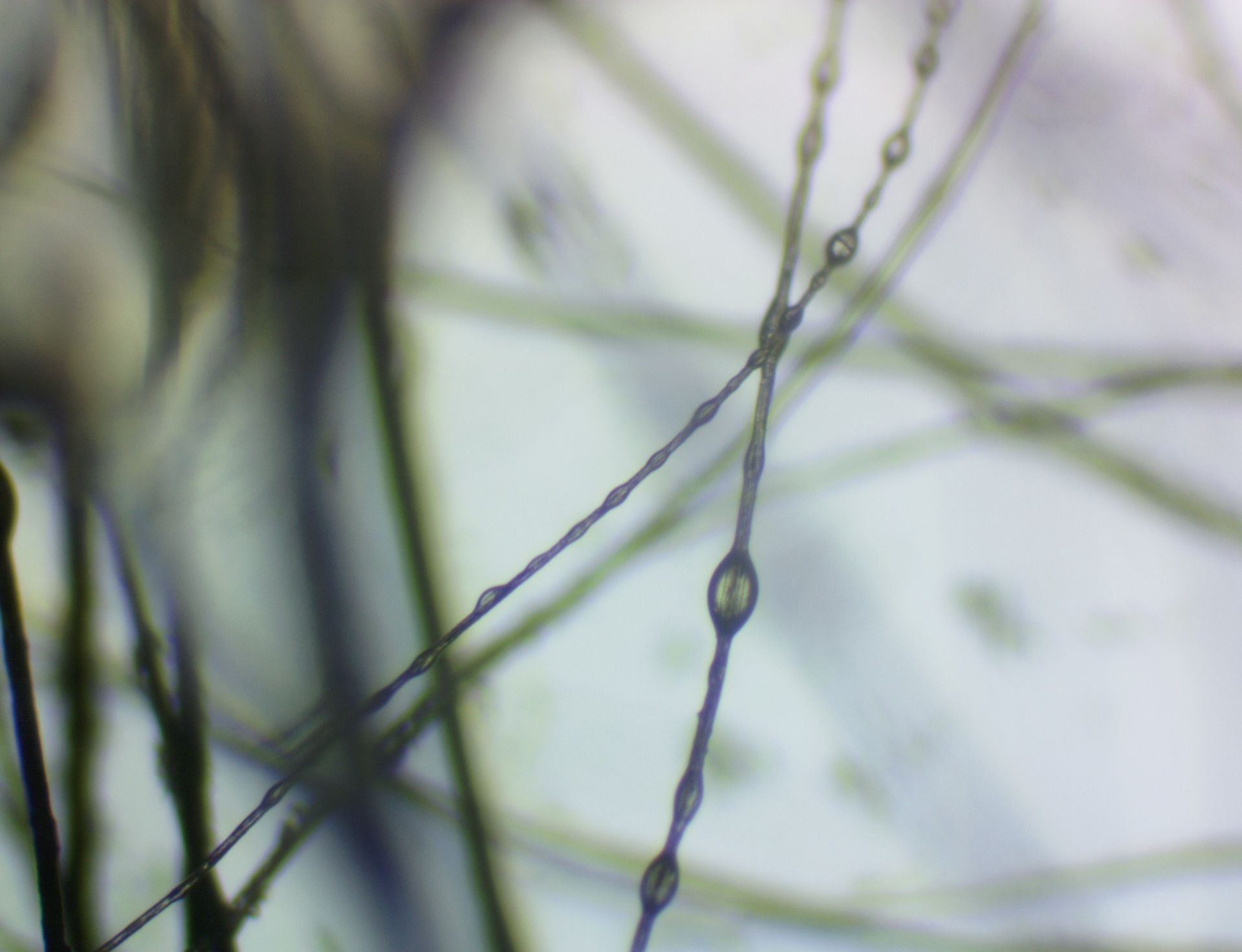 Vista microscópica de hebras de cabello con apariencia de cuentas.