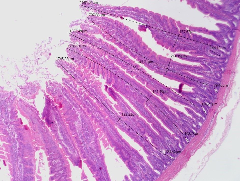 Vista microscópica de tejido teñido de rosa con mediciones que etiquetan las vellosidades.