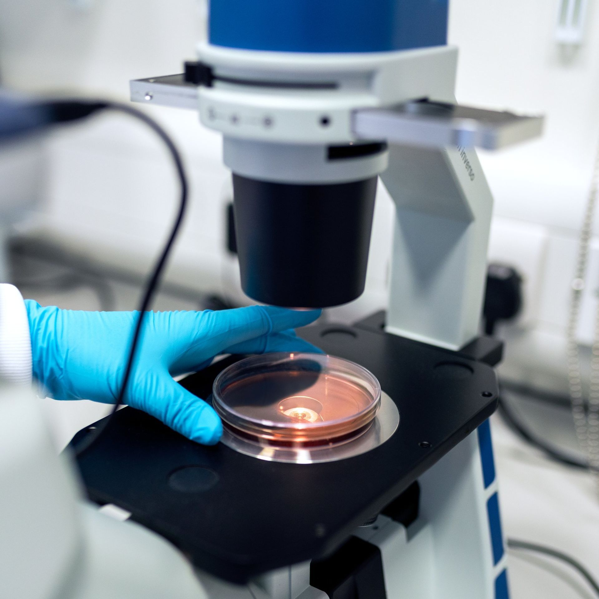 Persona con guantes azules examinando una placa de Petri bajo un microscopio.