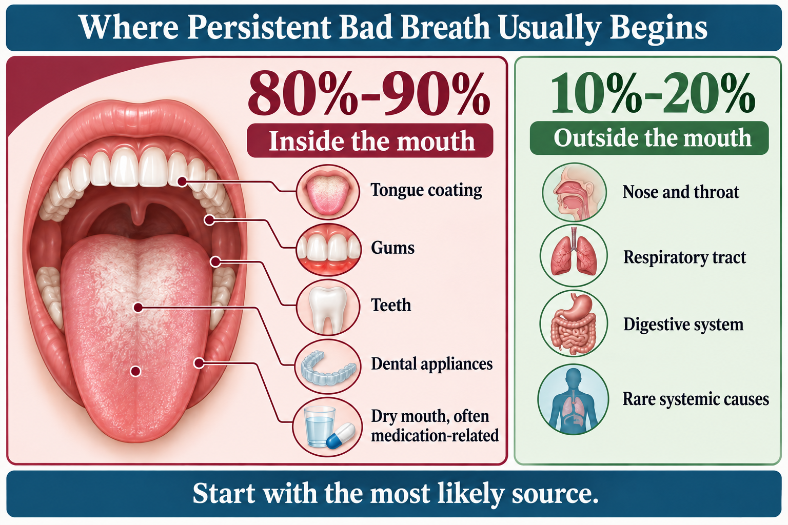 Diagram showing that an estimated 80 to 90 percent of persistent bad breath originates in the mouth and a smaller proportion comes from non-oral sources.