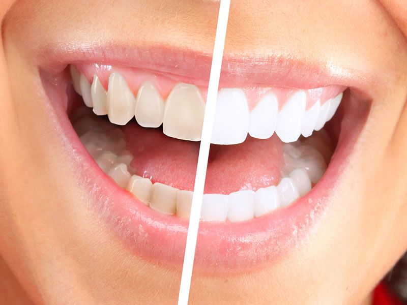 Cosmetic Dentistry