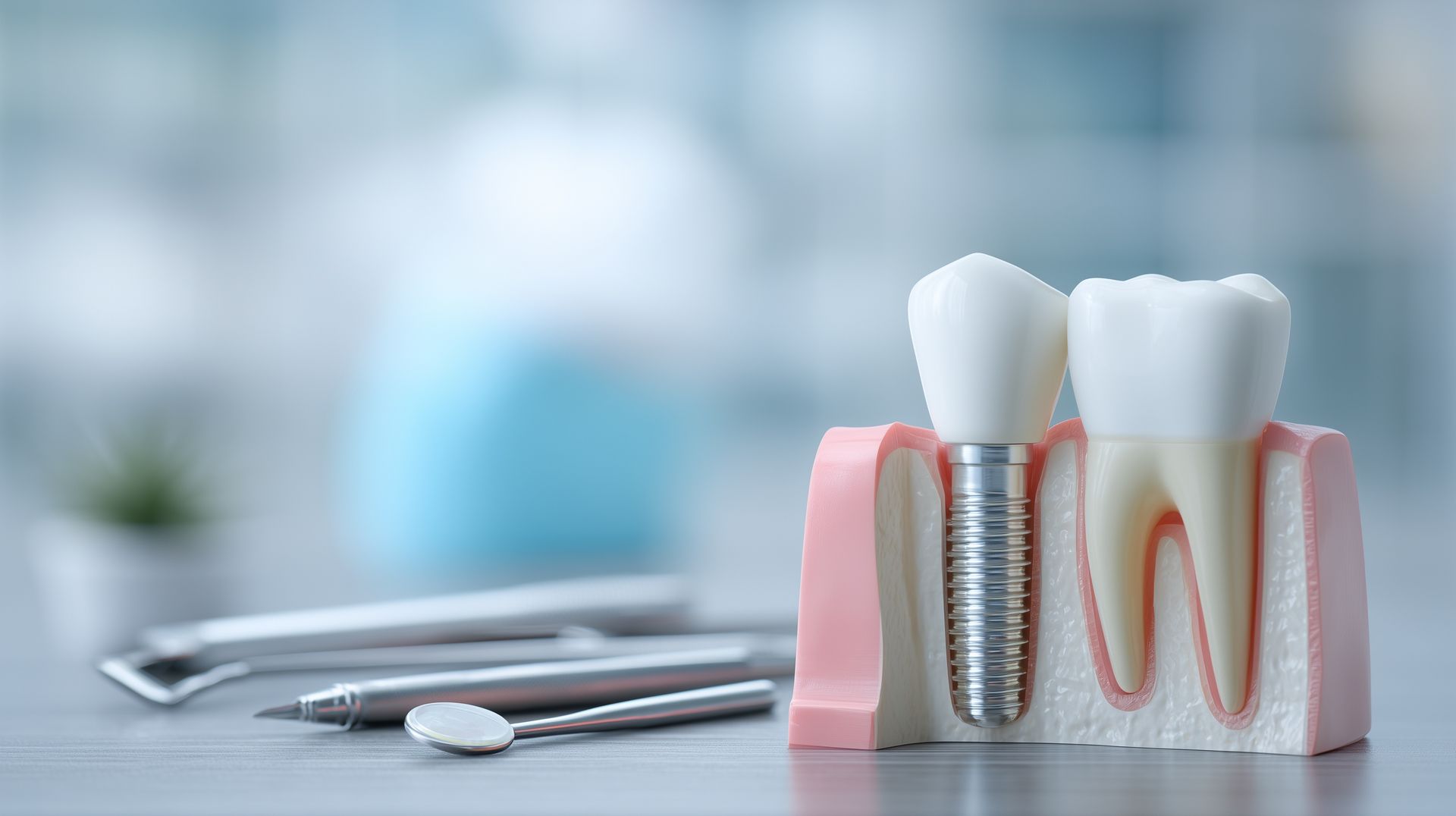 Dental implant model showing titanium post and crown next to a natural tooth
