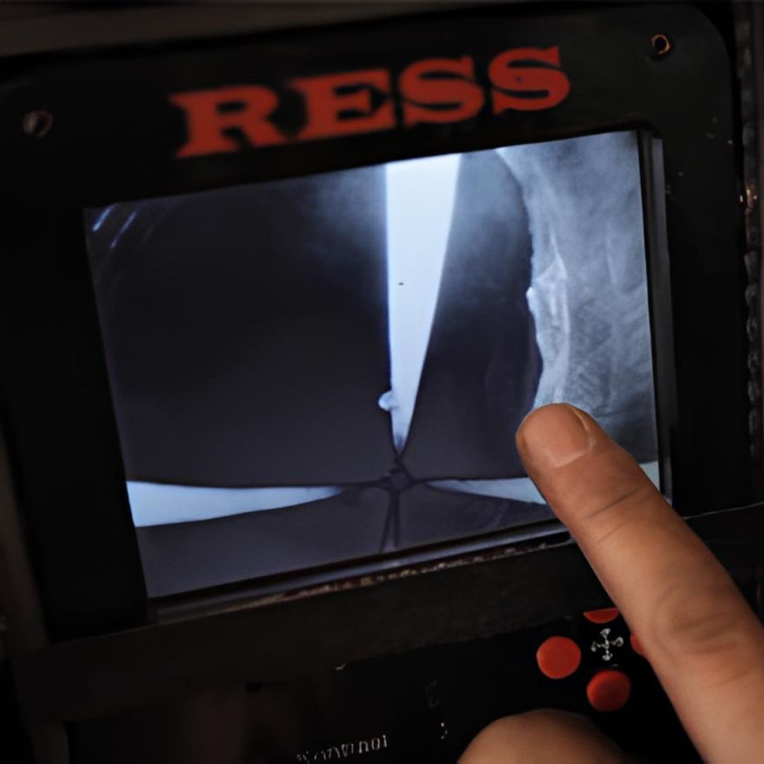 Ramonage camera endoscopique