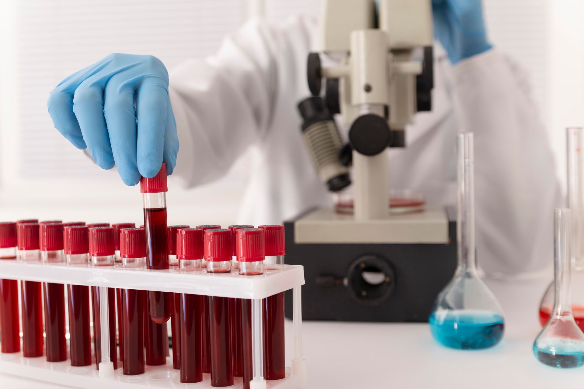 Mão enluvada colocando tubo de ensaio em estante de laboratório ao lado de microscópio e frascos de líquido azul.