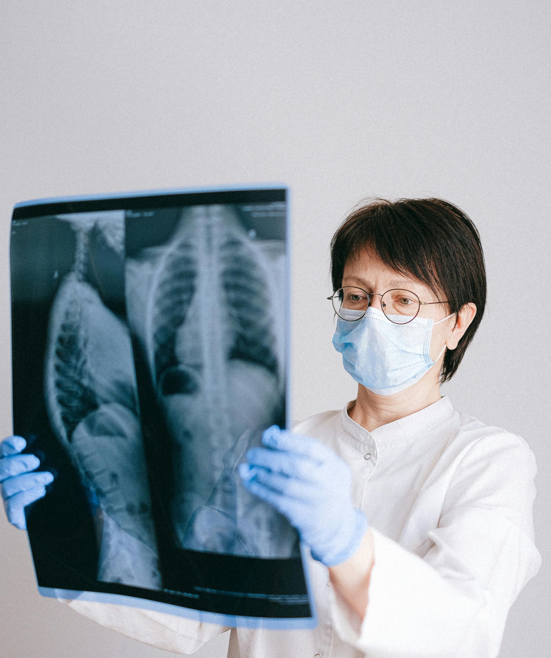 Médico de máscara examina radiografia de tórax contra uma parede lisa.