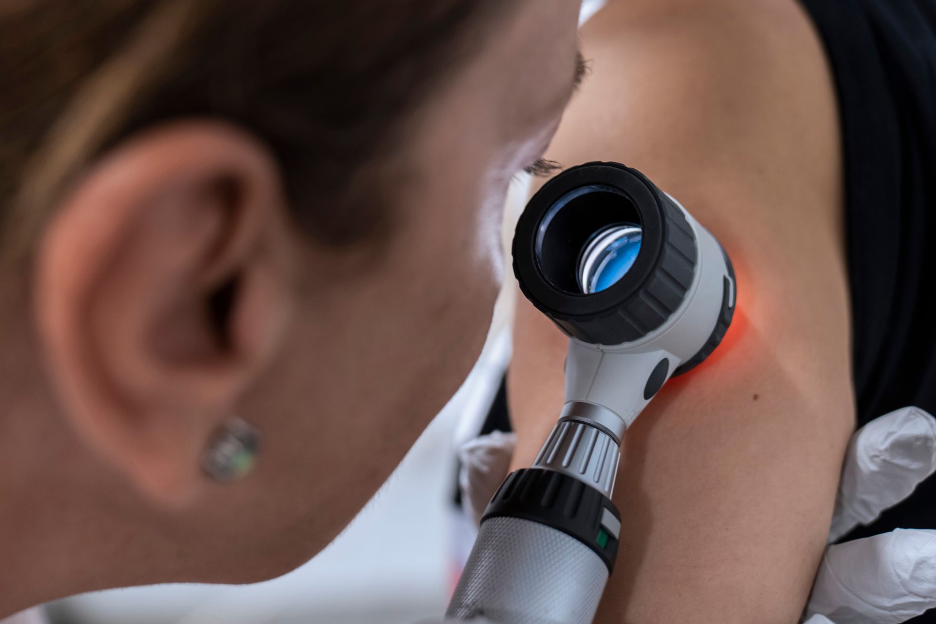 A woman is looking at a spot on her arm with a magnifying glass.