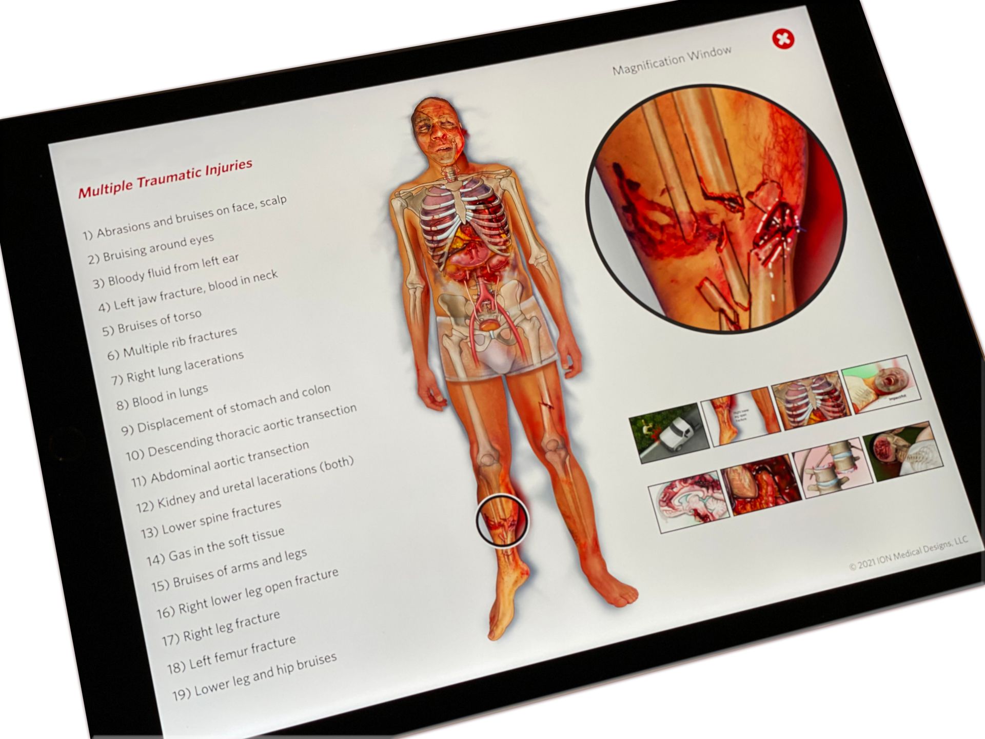 Showcase of Accurate and Visual Medical Illustrations | Ion Medical Designs