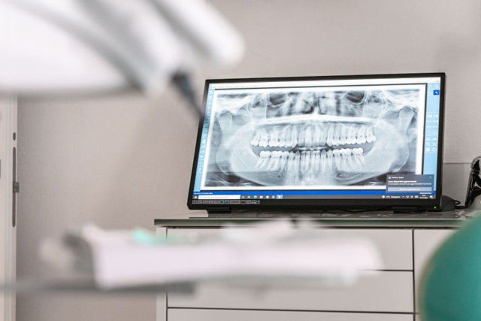 radiografia denti