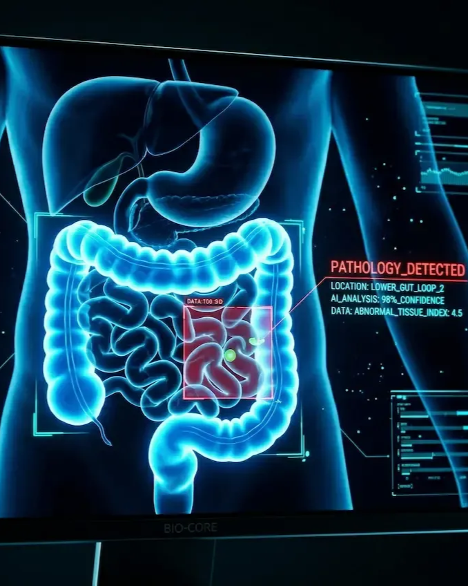 A digital medical display shows a blue human abdomen with a red-highlighted area of intestines marked