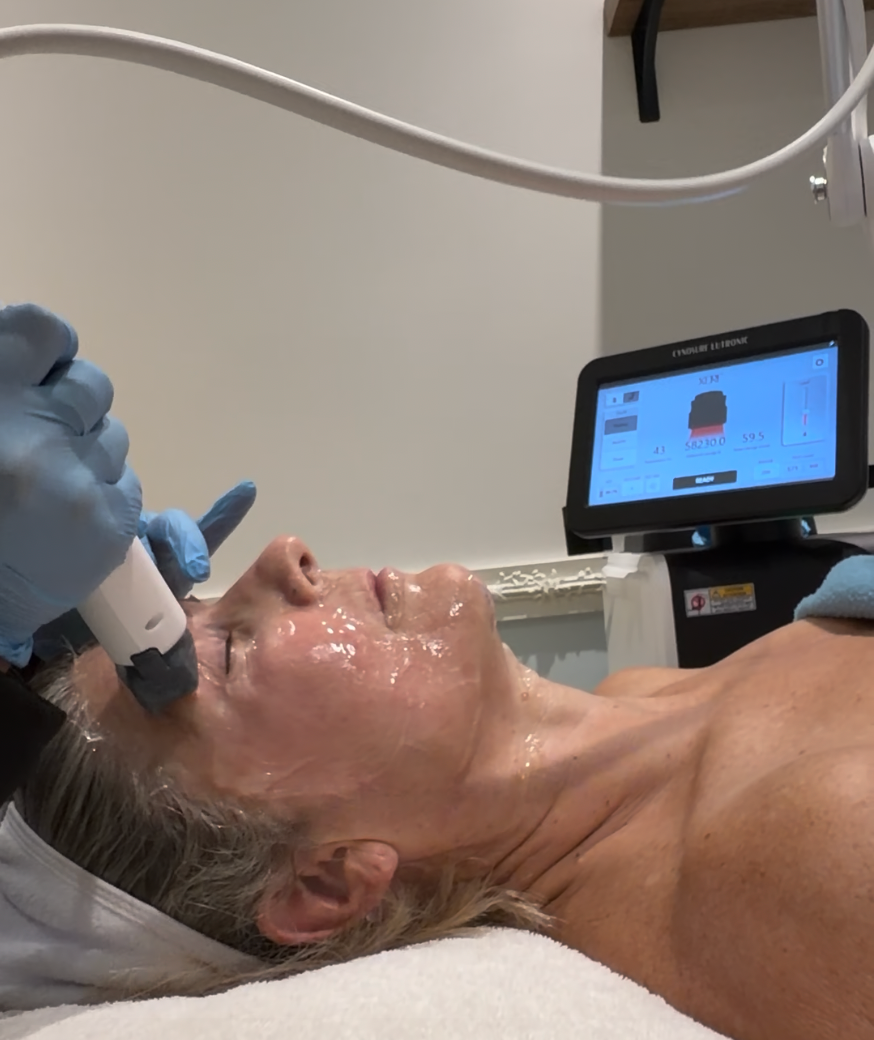 Person receiving a facial treatment with a device; device display visible.