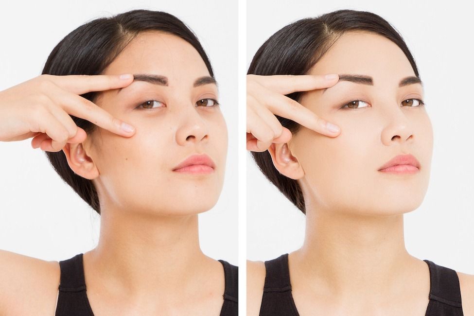 Woman performing an eye exercise, using fingers to stretch skin around the eyes.