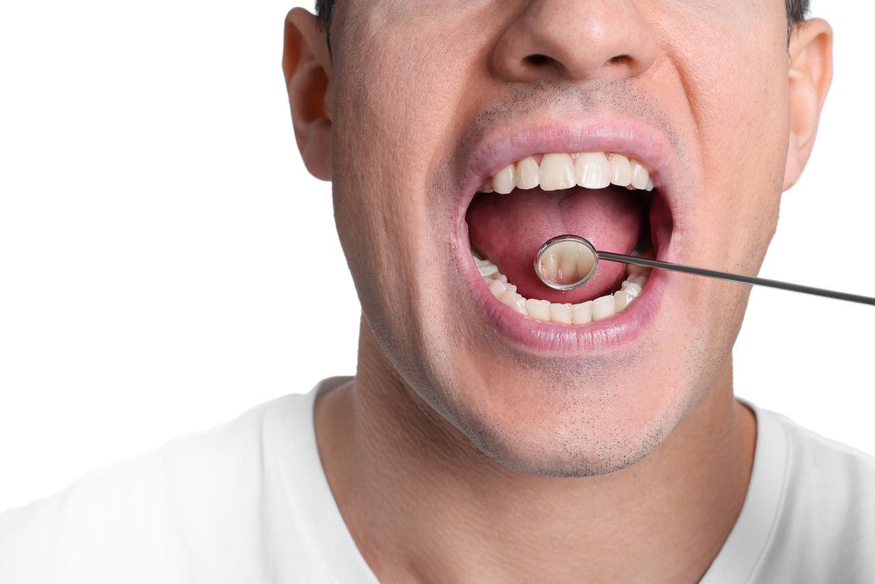 Close-up of a person with mouth open while a cotton swab is inspecting the tongue.