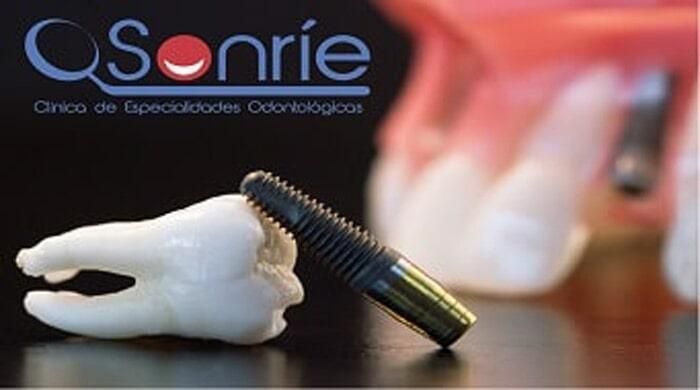 SONRIE CLÍNICA DE ESPECIALIDADES ODONTOLÓGICAS