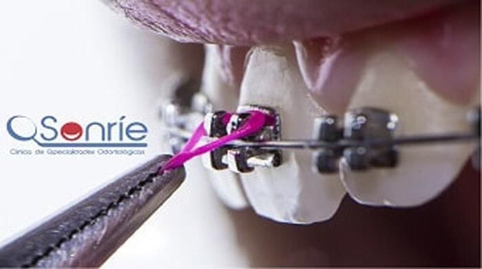 SONRIE CLÍNICA DE ESPECIALIDADES ODONTOLÓGICAS