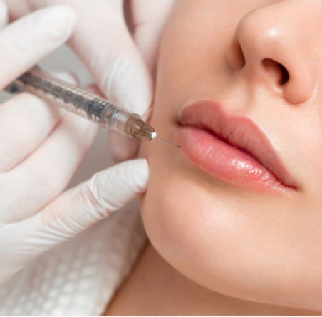 Lip Filler