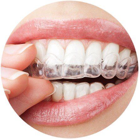 Invisalign for the Greenboro, NC area