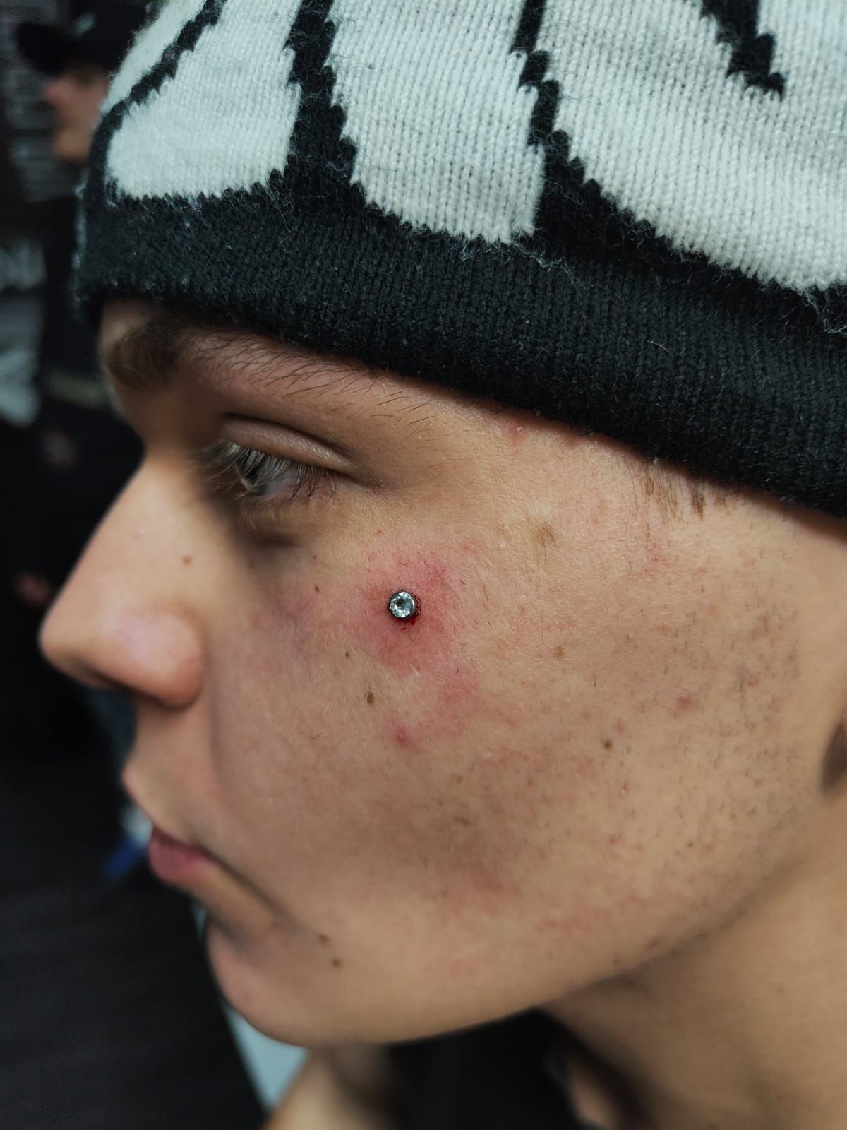 Profilo laterale di una persona che indossa un cappello di lana bianco e nero e un piercing a bottone sulla guancia.