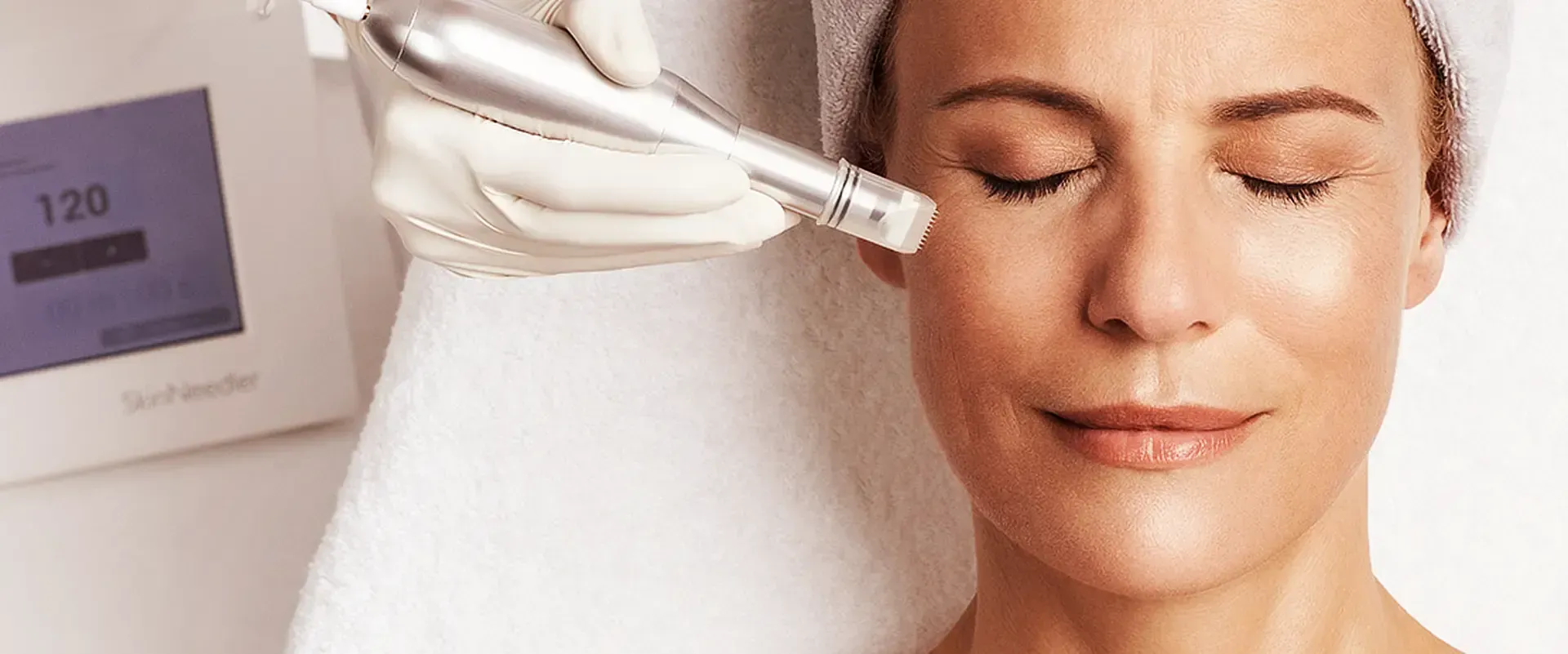 Professionelles Microneedling für Gesicht und Dekolleté in Basel