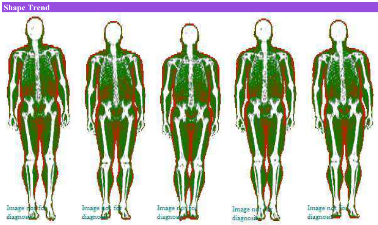 DEXA Scan