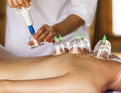 A person is getting a cupping treatment on their back.