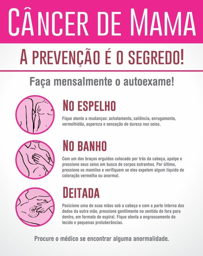 como-fazer-autoexame-mama-dra-graziele-cervantes-ginecologista-sao-paulo