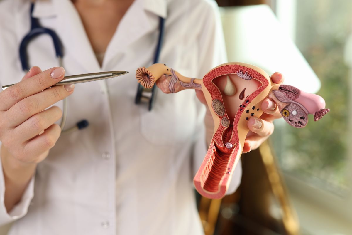 ooforoplastia-dra-graziele-cervantes-ginecologista-sao-paulo