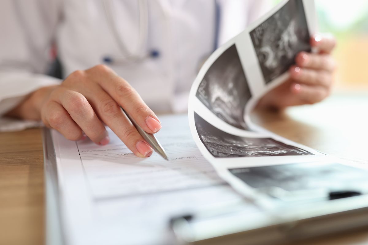 tratamento-hpv-dra-graziele-cervantes-ginecologista-sao-paulo