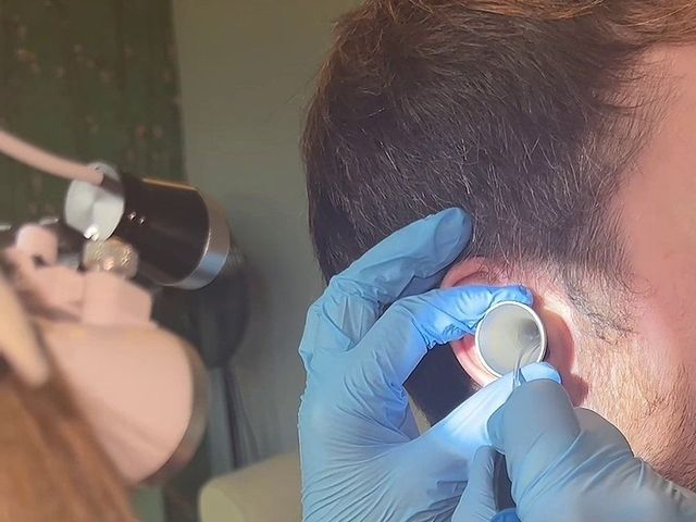 Ear microsuction in progress at Happy Ears, seen over the shoulder of the specialist wearing loupes