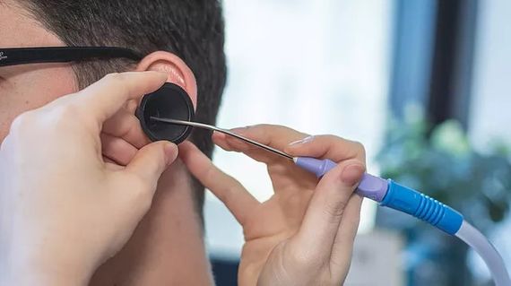 Microsuction being performed on a client