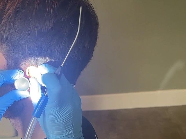 Microsuction ear wax removal at the Happy Ears clinic in Woodthorpe