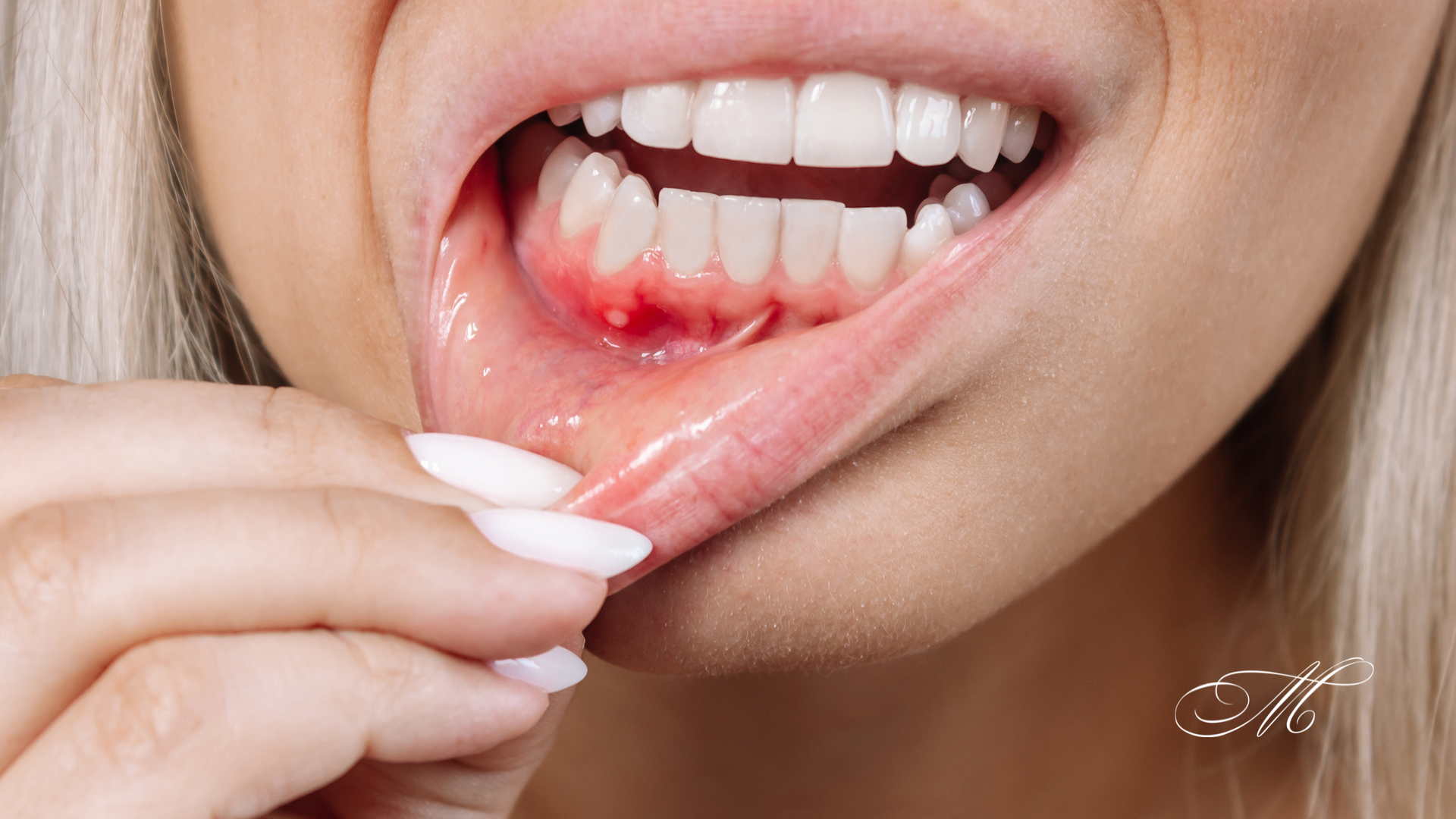 A close up of a woman 's mouth with a toothache.