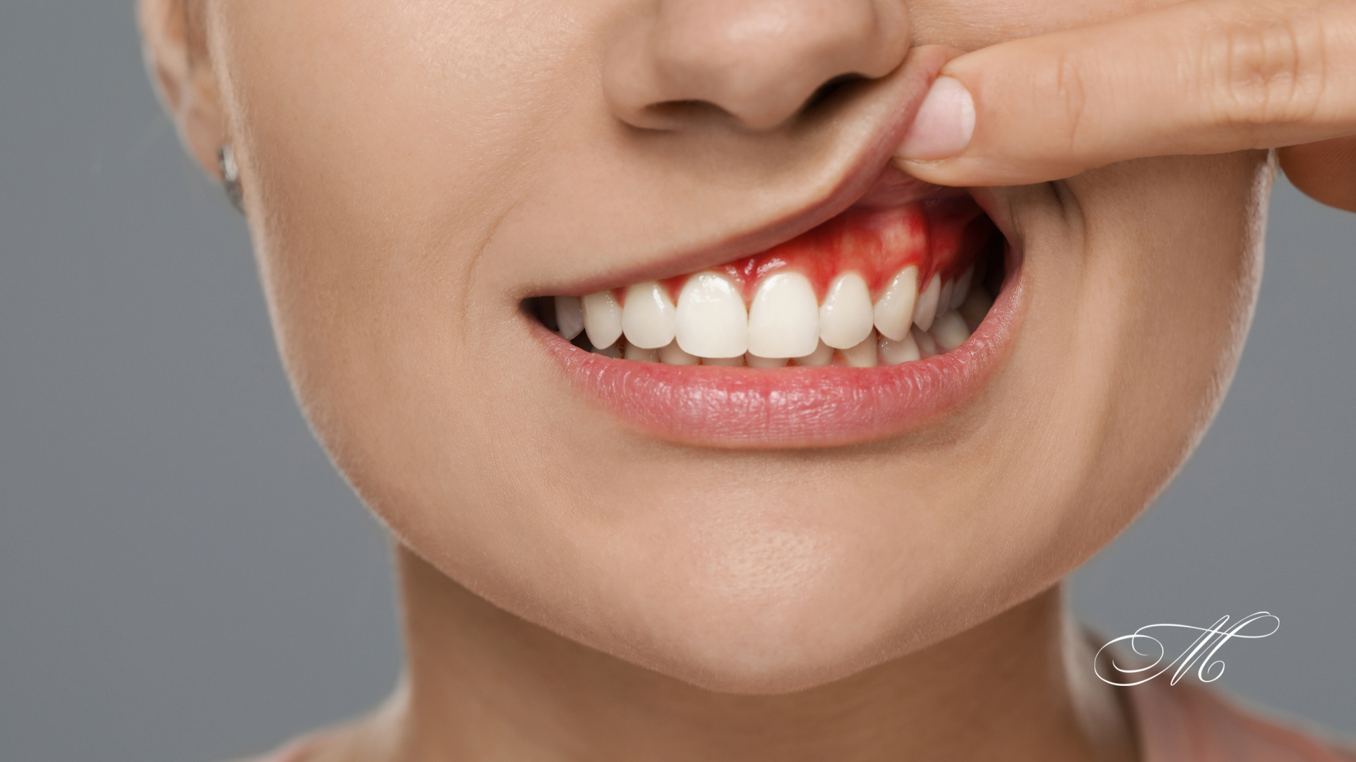 A close up of a woman 's mouth with a toothache.