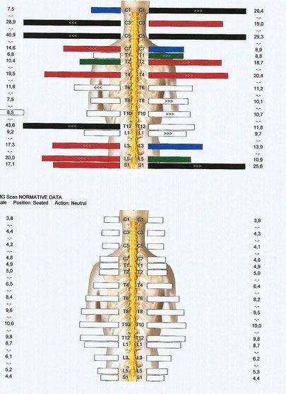 Ein Diagramm einer menschlichen Wirbelsäule mit farbigen Linien darauf