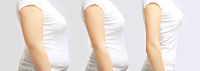 We Help Manage GLP-1 Skin Laxity During Weight Loss