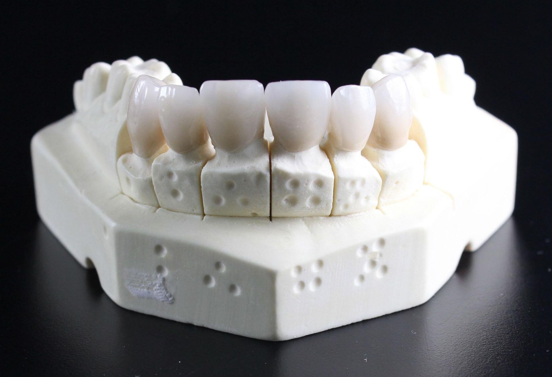 Dental model with white teeth and a white jaw mold on a black background