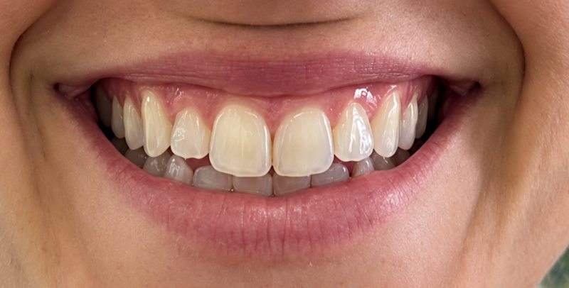 Close-up of a smiling mouth showing white teeth with a small gap between the front teeth