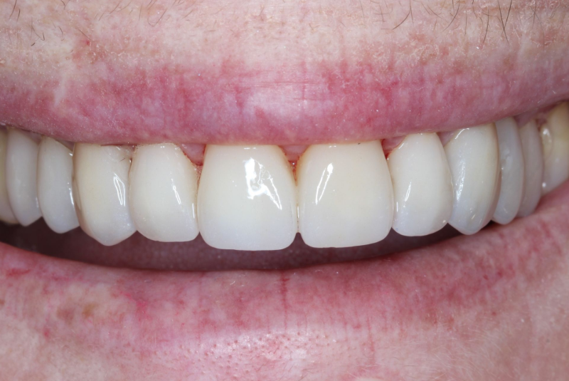 Close-up of a smiling mouth with white teeth and pink lips