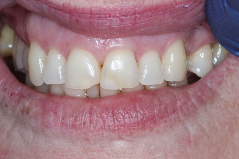 Close-up of a smiling mouth showing white teeth with a small gap between the front teeth