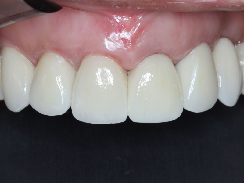 Close-up of a smiling mouth with white teeth and pink lips