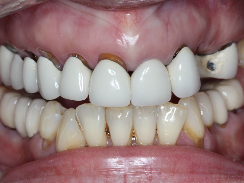 Close-up of a smiling mouth showing white teeth with a small gap between the front teeth