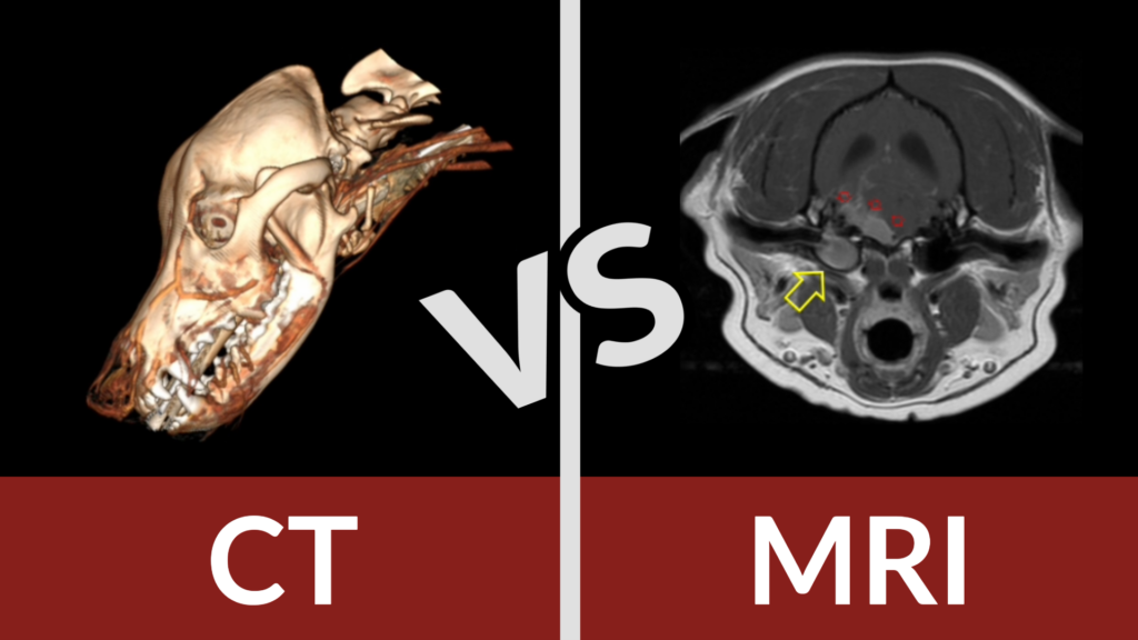 Ct Scan V Mri Scan