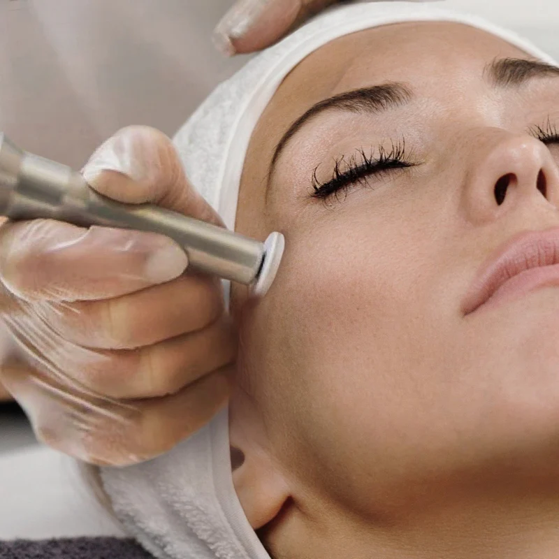 Woman receiving facial microdermabrasion treatment; setting is a spa, close up.