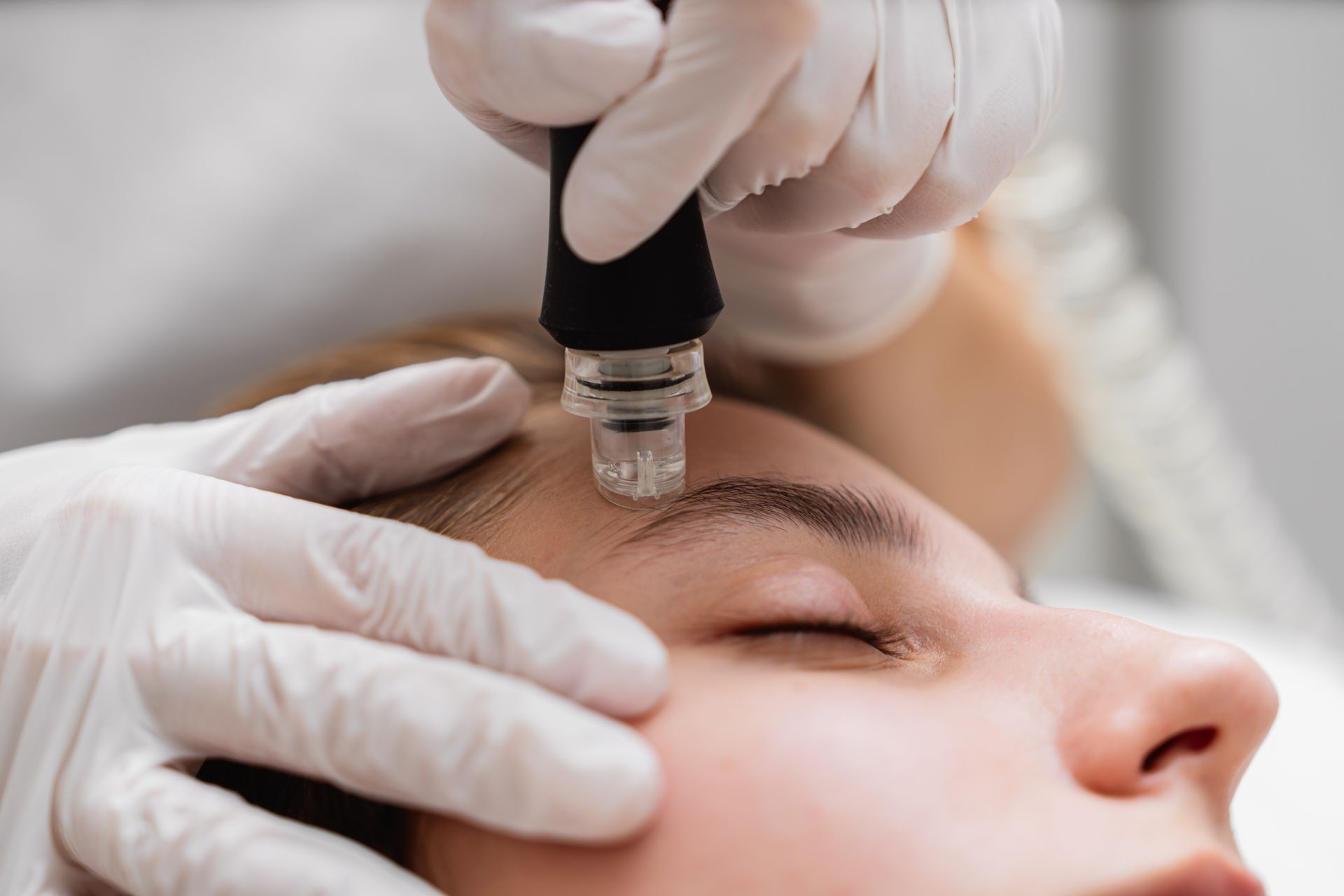 Person receiving skin treatment on forehead with device, hands in gloves.