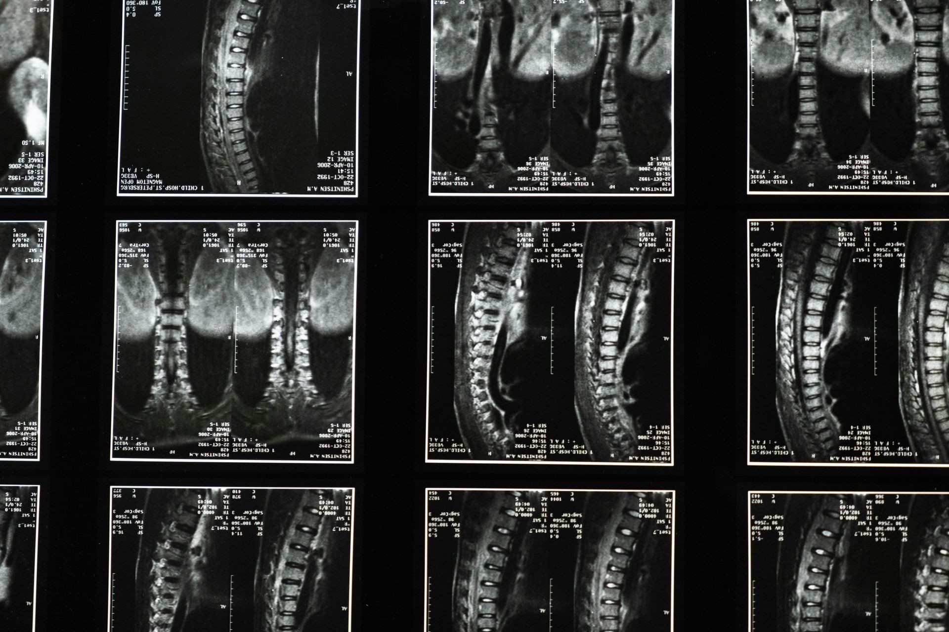 Grid of black-and-white dental X-rays showing teeth and jaw structures from multiple angles