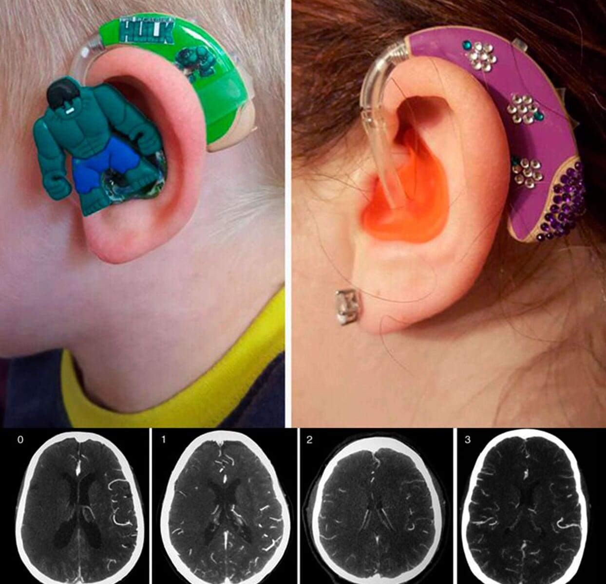 UNIDAD DE AUDIOLOGÍA COMPUTARIZADA - DIAGNÓSTICO DEL OÍDO