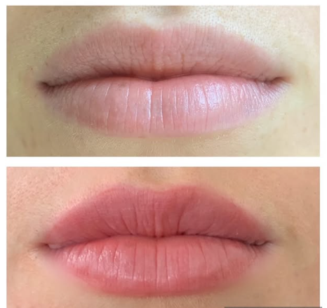nano lips