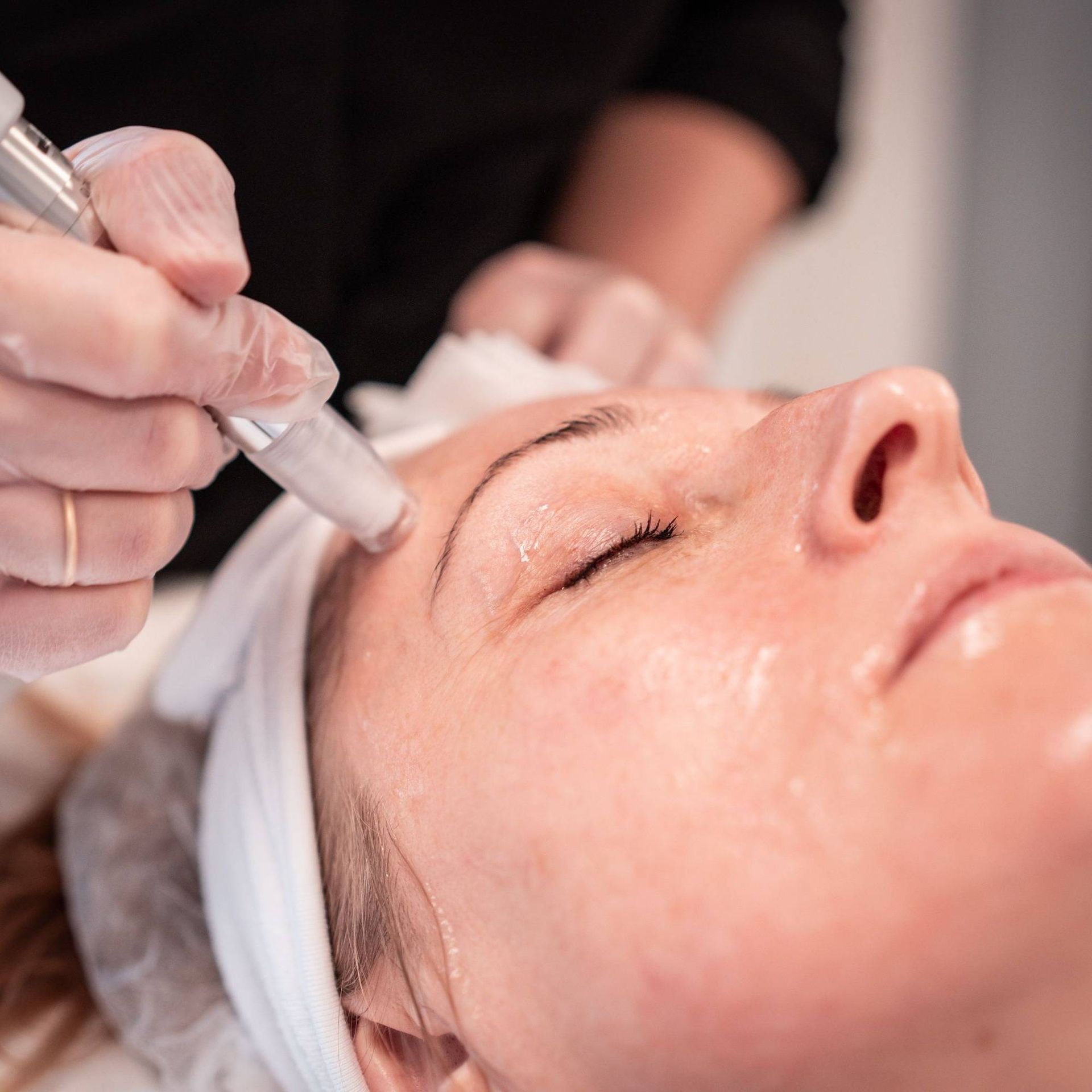 XCellaris Twist behandling i Kristiansand