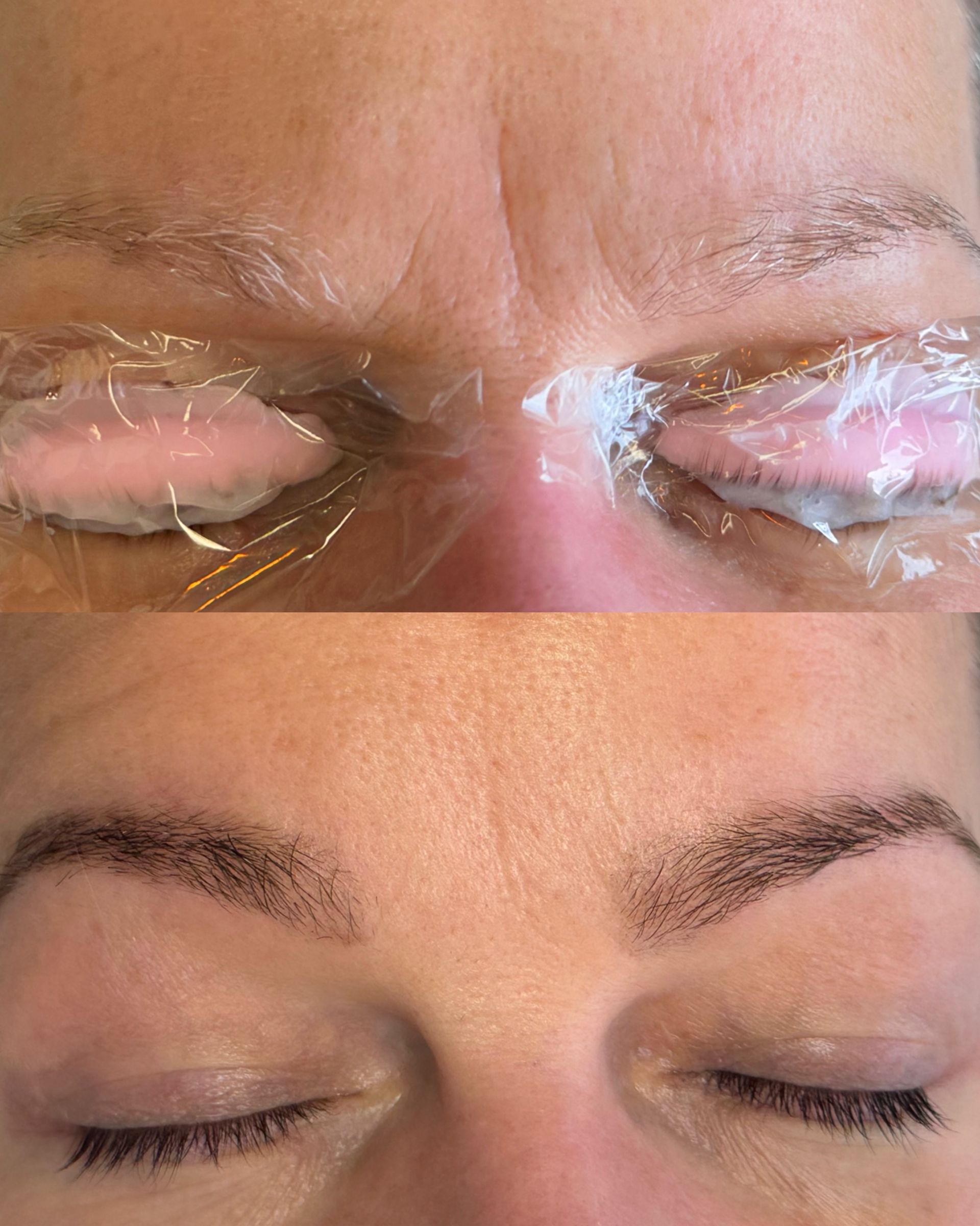 Close-up of two people’s closed eyes with clear medical gel or tape around the eyelids and bridge of the nose