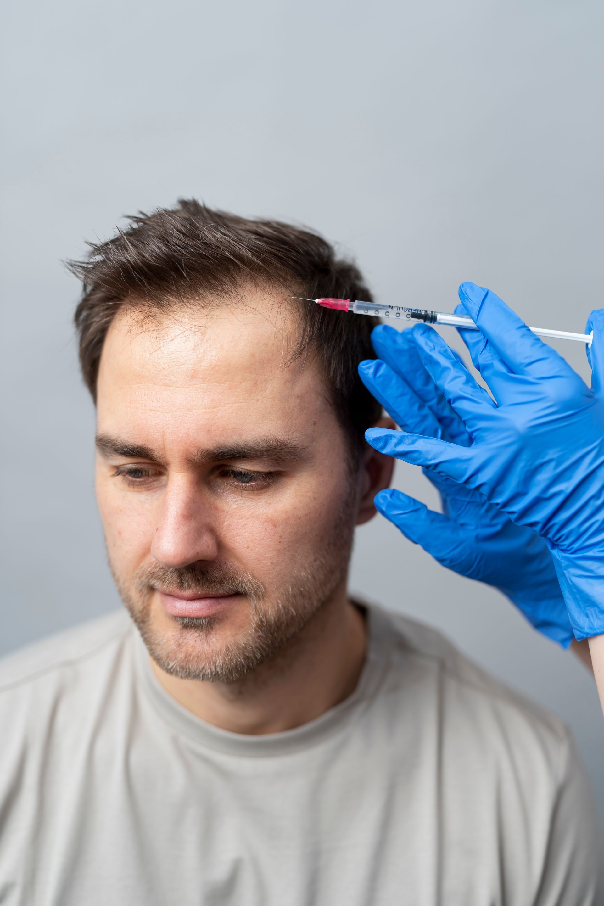 man getting prp treatment